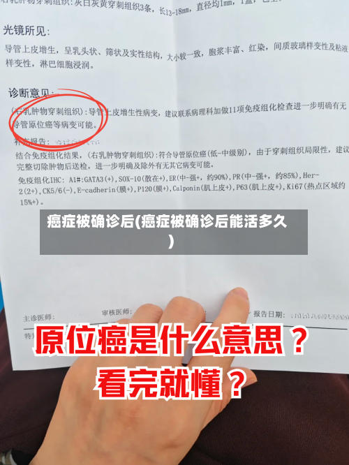 癌症被确诊后(癌症被确诊后能活多久)-第2张图片